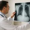 Врач смотрит на рентген-снимок