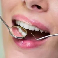 Зубы, стоматология