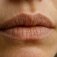 Больше губы не трескаются: начала использовать эти советы и забыла о сухости